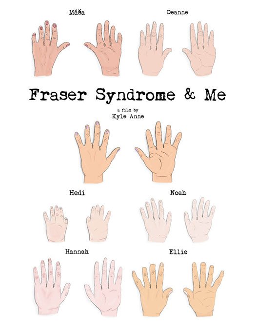 Fraser Syndrome & Me - Poster